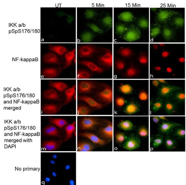 Phospho-IKK alpha/beta (Ser176, Ser180) Antibody in Immunocytochemistry (ICC/IF)