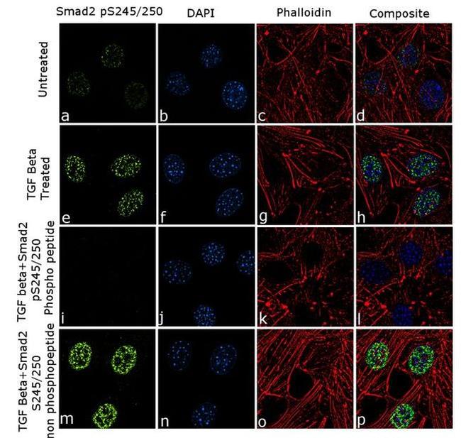 Phospho-SMAD2 (Ser245, Ser250) Antibody in Immunocytochemistry (ICC/IF)