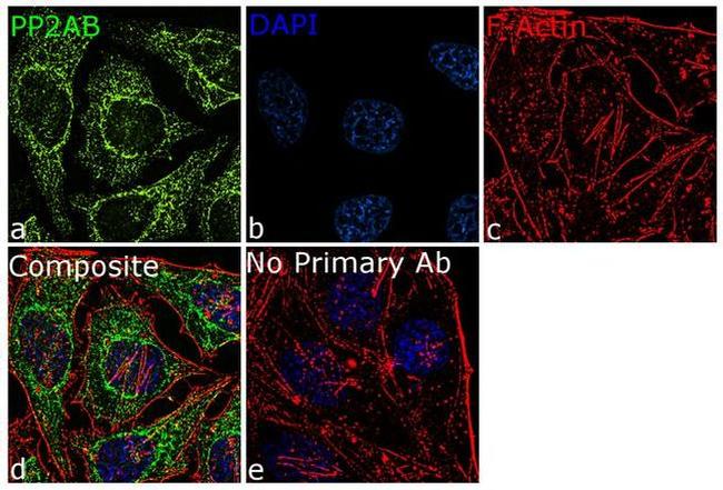 PPP2R2A Antibody in Immunocytochemistry (ICC/IF)