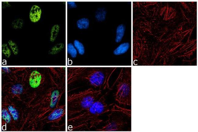 RNF20 Antibody in Immunocytochemistry (ICC/IF)