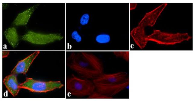 ATG4B Antibody in Immunocytochemistry (ICC/IF)