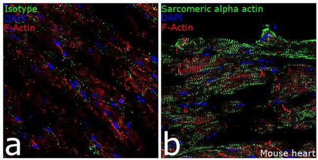 alpha Actinin 2 Antibody in Immunohistochemistry (Frozen) (IHC (F))