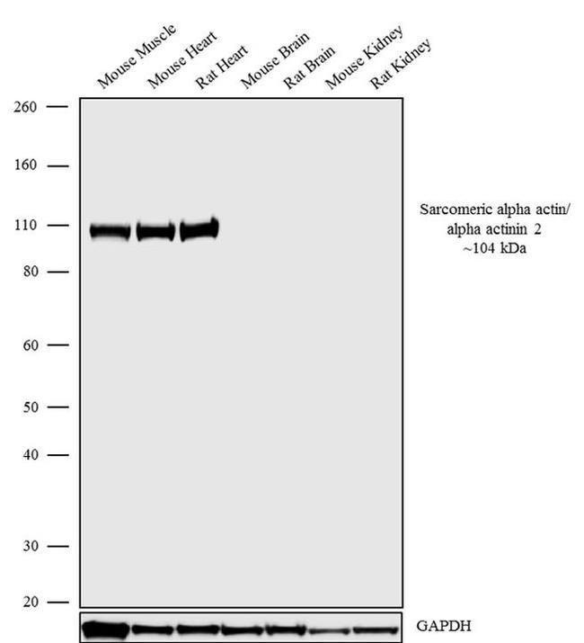 alpha Actinin 2 Antibody in Western Blot (WB)