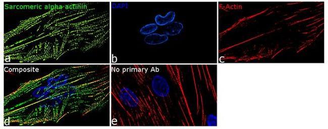 alpha Actinin 2 Antibody in Immunocytochemistry (ICC/IF)