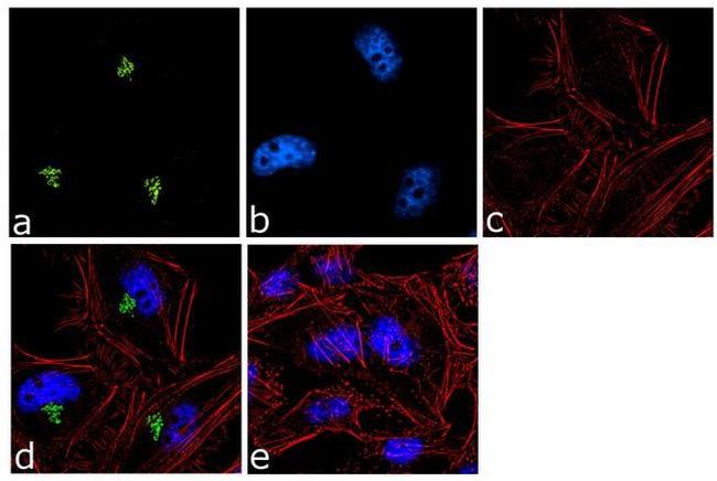 Spectrin beta-3 Antibody in Immunocytochemistry (ICC/IF)