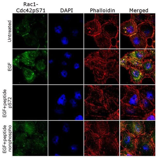 Phospho-RAC1/CDC42 (Ser71) Antibody in Immunocytochemistry (ICC/IF)