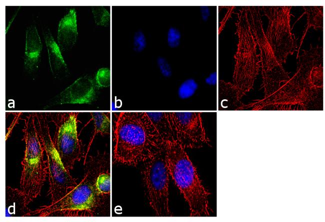 Tyrosine Hydroxylase Antibody in Immunocytochemistry (ICC/IF)