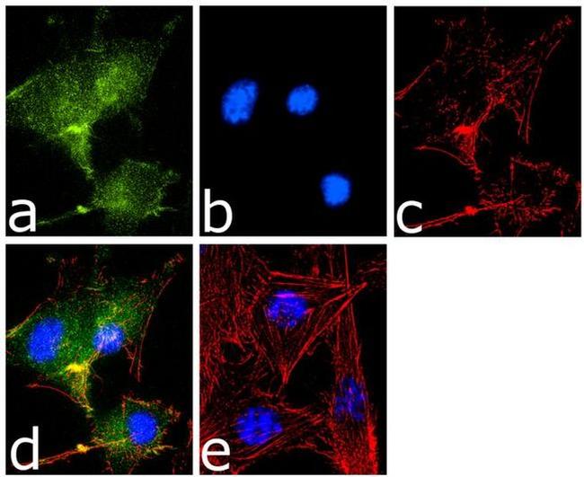 NOTCH2 Antibody in Immunocytochemistry (ICC/IF)