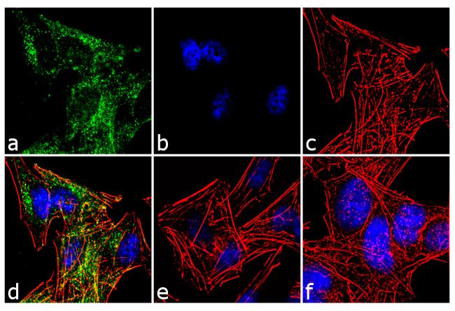 TrkC Antibody in Immunocytochemistry (ICC/IF)