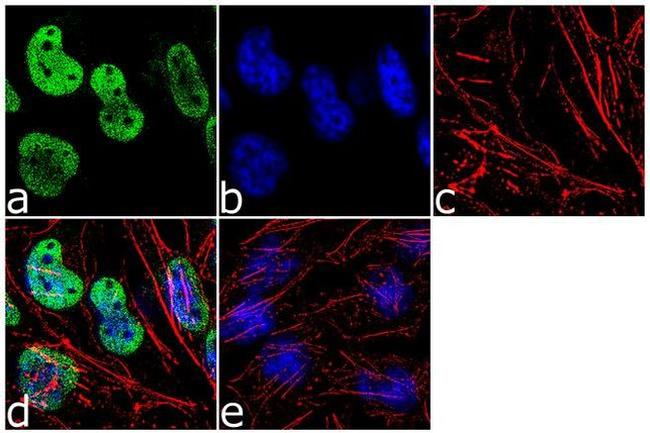 NSUN2 Antibody in Immunocytochemistry (ICC/IF)