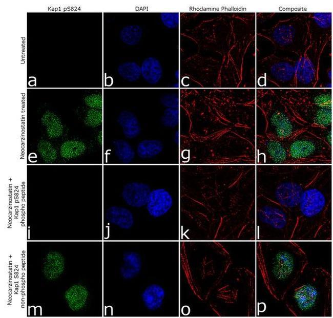 Phospho-TRIM28 (Ser824) Antibody in Immunocytochemistry (ICC/IF)