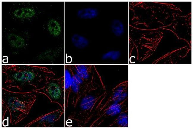 RAD1 Antibody in Immunocytochemistry (ICC/IF)