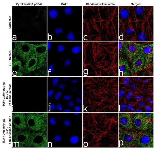 Phospho-Cytokeratin 8 (Ser432) Antibody in Immunocytochemistry (ICC/IF)