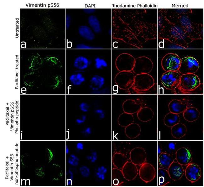 Phospho-Vimentin (Ser56) Antibody in Immunocytochemistry (ICC/IF)