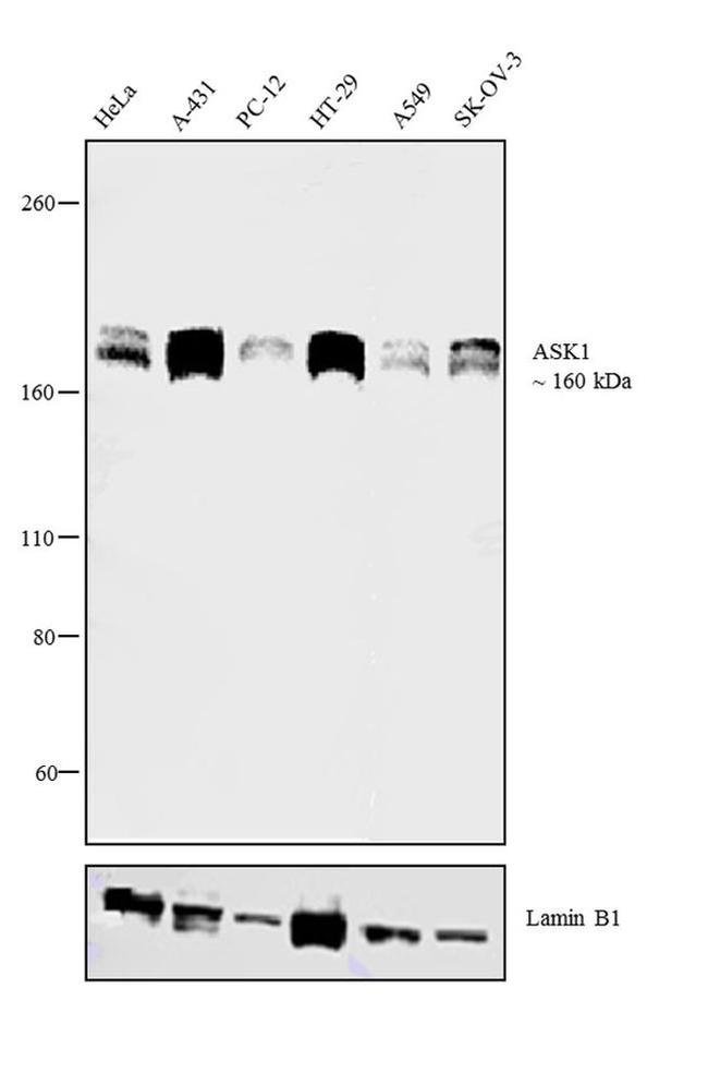 ASK1 Antibody in Western Blot (WB)