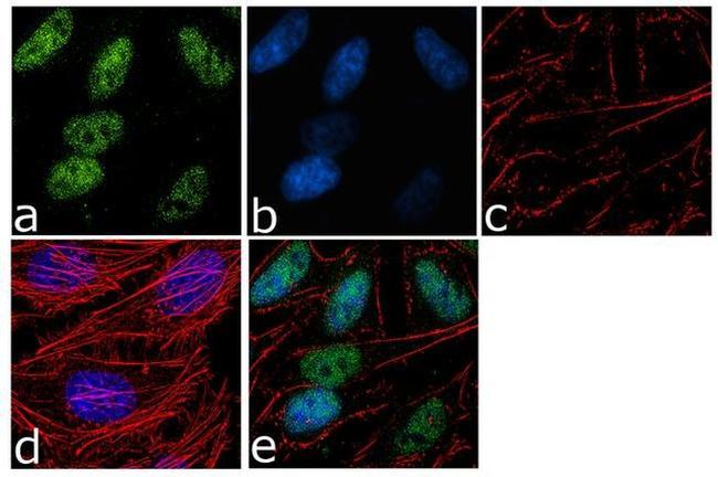 SMURF2 Antibody in Immunocytochemistry (ICC/IF)