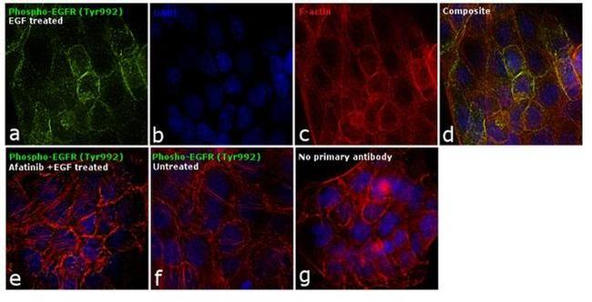 Phospho-EGFR (Tyr992) Antibody in Immunocytochemistry (ICC/IF)