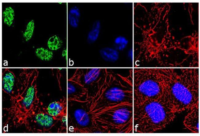 PARP1 Antibody in Immunocytochemistry (ICC/IF)