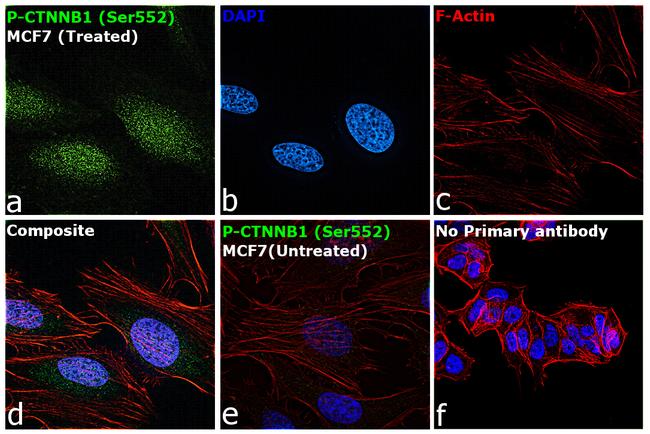 Phospho-beta Catenin (Ser552) Antibody in Immunocytochemistry (ICC/IF)