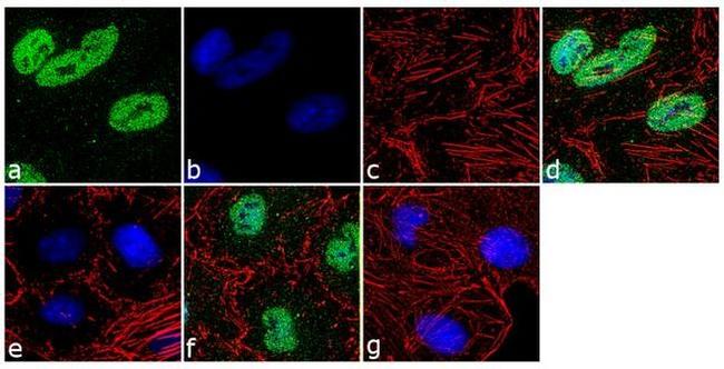 Phospho-Paxillin (Ser178) Antibody in Immunocytochemistry (ICC/IF)