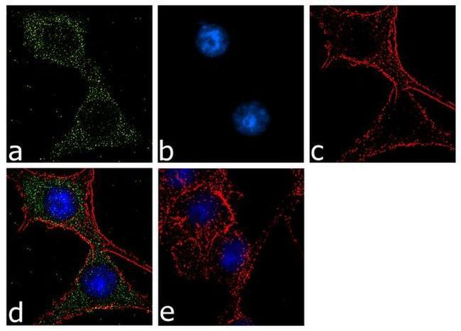 Calbindin D28K Antibody in Immunocytochemistry (ICC/IF)