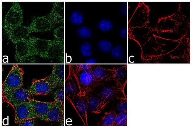 NME1 Antibody in Immunocytochemistry (ICC/IF)