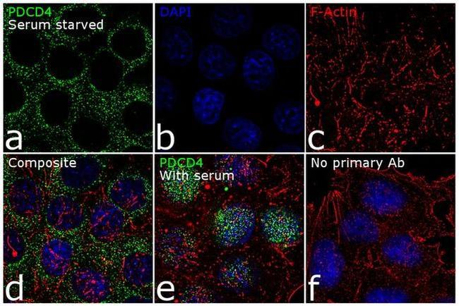 PDCD4 Antibody in Immunocytochemistry (ICC/IF)