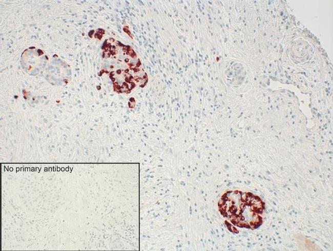 GPR68 Antibody in Immunohistochemistry (IHC)