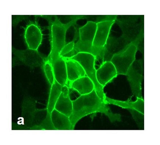 mGLuR2 Antibody in Immunocytochemistry (ICC/IF)