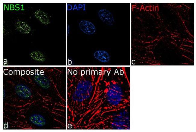 NBS1 Antibody in Immunocytochemistry (ICC/IF)