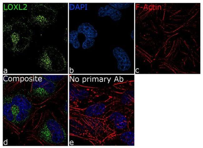 LOXL2 Antibody in Immunocytochemistry (ICC/IF)