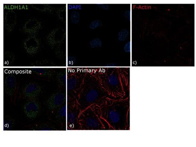 ALDH1A1 Antibody in Immunocytochemistry (ICC/IF)