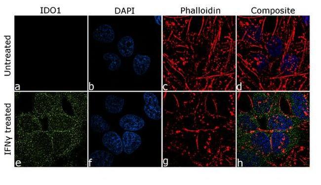 IDO Antibody in Immunocytochemistry (ICC/IF)