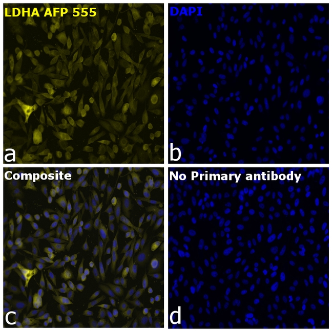 LDHA Antibody in Immunocytochemistry (ICC/IF)