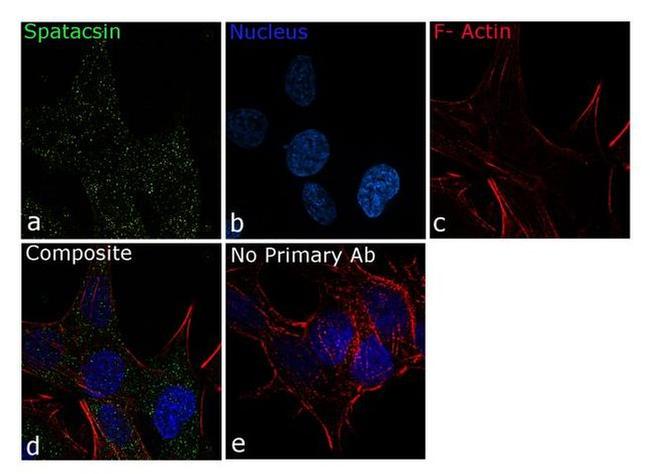 SPG11 Antibody in Immunocytochemistry (ICC/IF)