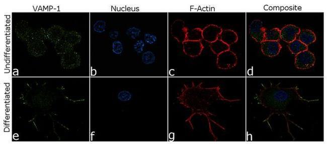 VAMP1 Antibody in Immunocytochemistry (ICC/IF)