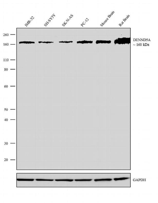 DENND5A Antibody in Western Blot (WB)