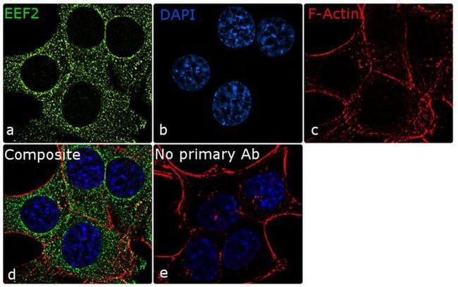 EEF2 Antibody in Immunocytochemistry (ICC/IF)