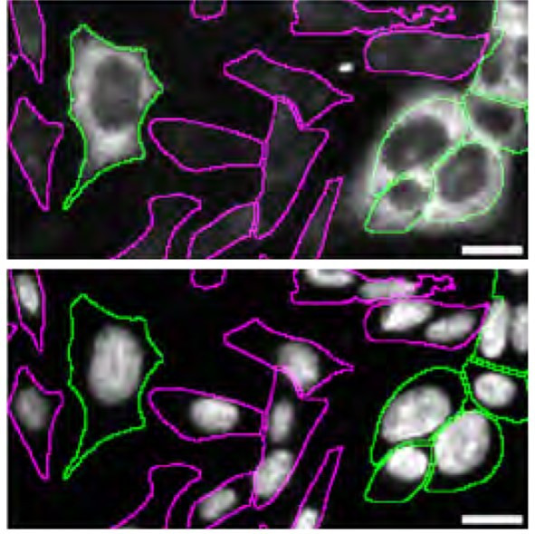 CK2 alpha-1 Antibody in Immunocytochemistry (ICC/IF)