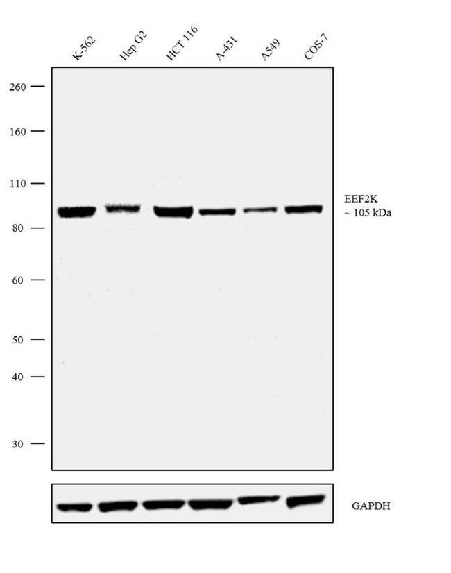 EEF2K Antibody in Western Blot (WB)