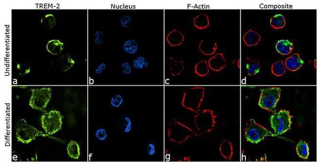 TREM2 Antibody in Immunocytochemistry (ICC/IF)