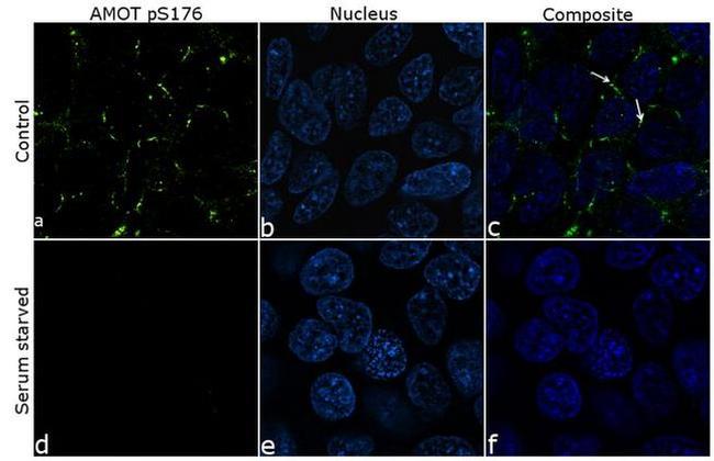 Phospho-AMOT (Ser175) Antibody in Immunocytochemistry (ICC/IF)