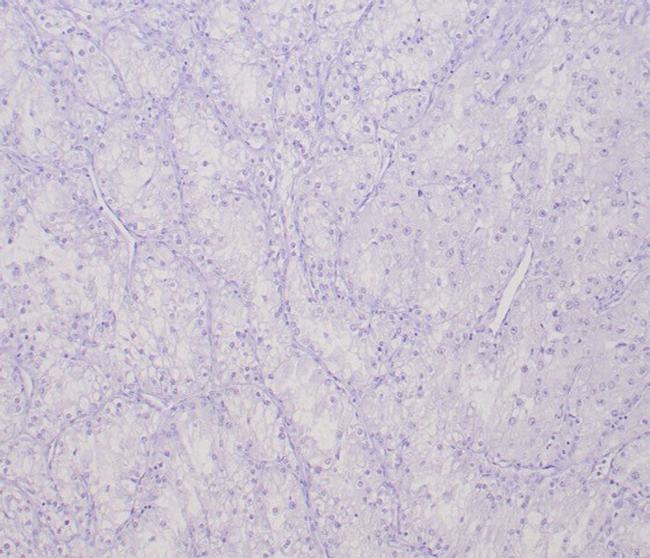 Transcription factor E3/TFE3 (Transcription Factor) Antibody in Immunohistochemistry (Paraffin) (IHC (P))