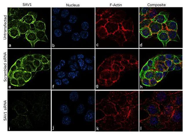 SAV1 Antibody in Immunocytochemistry (ICC/IF)