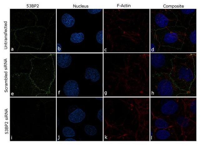 53BP2 Antibody in Immunocytochemistry (ICC/IF)