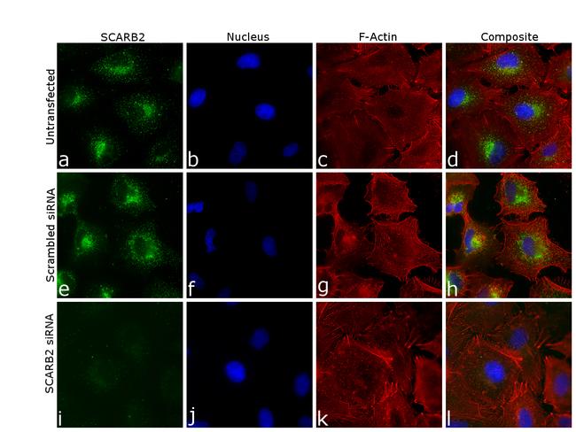 LIMP2 Antibody in Immunocytochemistry (ICC/IF)