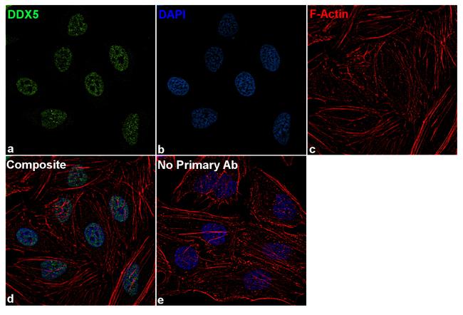 DDX5 Antibody in Immunocytochemistry (ICC/IF)