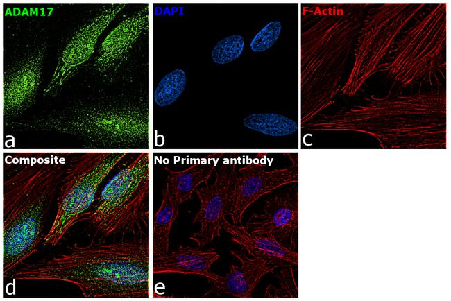 ADAM17 Antibody in Immunocytochemistry (ICC/IF)