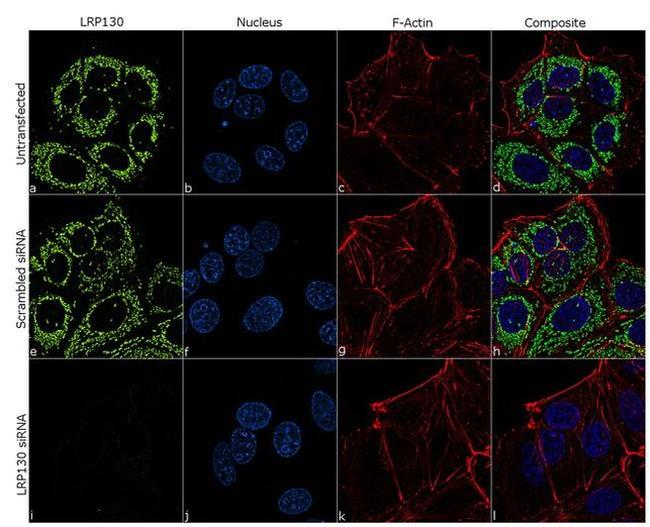 LRP130 Antibody in Immunocytochemistry (ICC/IF)