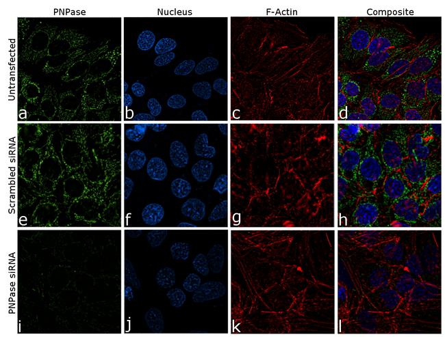 PNPase Antibody in Immunocytochemistry (ICC/IF)